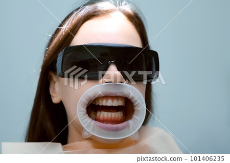 Woman with yellow teeth with retractor in her mouth is waiting dentist. Woman with yellow teeth with retractor in her mouth is waiting dentist. 101406235