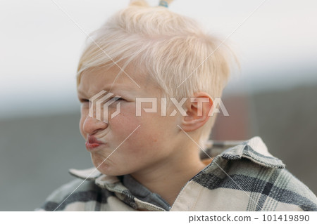 Cute albino boy making a funny face 101419890