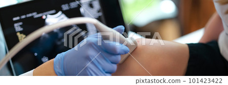 Ultrasound diagnostics of knee joint of little child 101423422