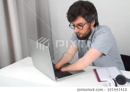 Disabled man with amputated two stump hands working typing on laptop at home. Disabled man with amputated two stump hands working typing on laptop at home. 101441418