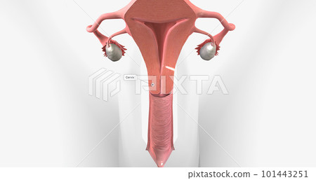 Cervical cancer is a disease that affects the cervix, characterized by tumor growth. 101443251