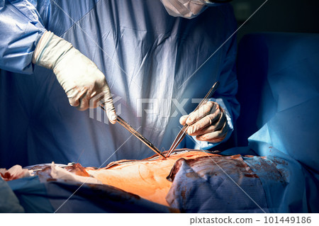 Close-up of the hands of a surgeon sewing up the stomach after surgery on the stomach, stomach cancer, hands of the surgeon in gloves, real operation, close-up 101449186
