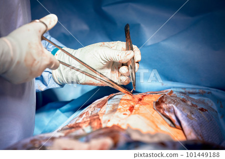 Close-up of the hands of a surgeon sewing up the stomach after surgery on the stomach, stomach cancer, hands of the surgeon in gloves, real operation, close-up 101449188