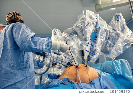 Surgery Da Vinci. Minimally invasive robotic surgery with the da Vinci surgical system. medical robot. Robotic Surgery. Robot-assisted medical operation. Medical operation involving robot. Surgery Da Vinci. Minimally invasive robotic surgery with the da Vinci surgical system. medical robot. Robotic Surgery. Robot-assisted medical operation. Medical operation involving robot. 101459370