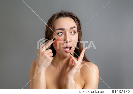 The concept of rosacea. A young Caucasian woman points her finger in surprise at a red rosacea cheek. Copy space. Gray background The concept of rosacea. A young Caucasian woman points her finger in surprise at a red rosacea cheek. Copy space. Gray background 101482370