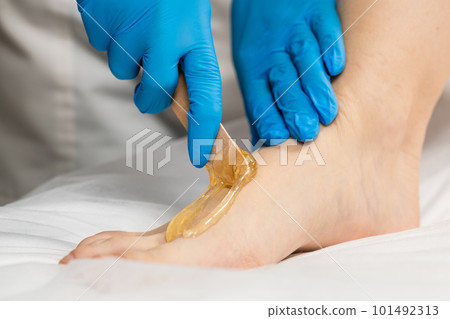 Hair removal process on female leg with epilation. 101492313
