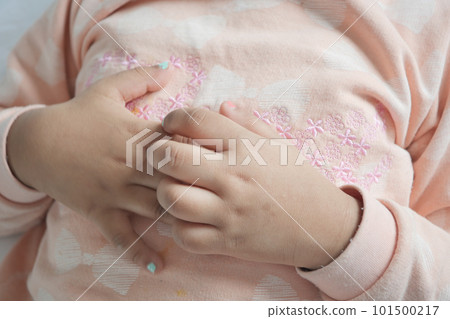 child hand suffering from itching skin  101500217