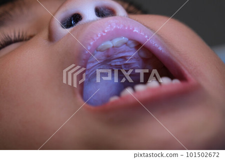 Close-up inside the oral cavity of a healthy child with beautiful rows of baby teeth. Young girl opens mouth revealing upper and lower teeth, hard palate, soft palate, dental and oral health checkup. 101502672