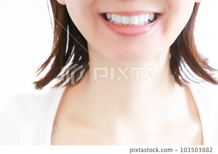 女性口腔牙齒對齊圖像 101503882