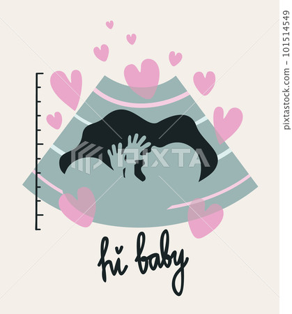 Prenatal ultrasound. Vector illustration with hearts and lettering isolated on light beige background. 101514549