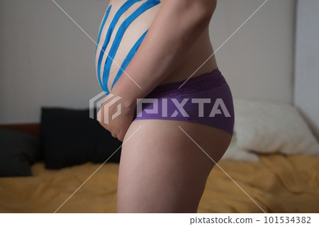 Kinesiology taping.kinesiology tape to patient belly.Anti-cellulite procedure for slim tummy and hips.cellulite removal, recovery concept.Weight loss concept. 101534382