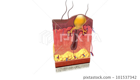 Acne is caused by a combination of factors acting on sebaceous glands and hair follicles in the skin. 101537342