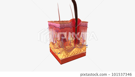 Skin reaction after insect bite Skin reaction after insect bite 101537346