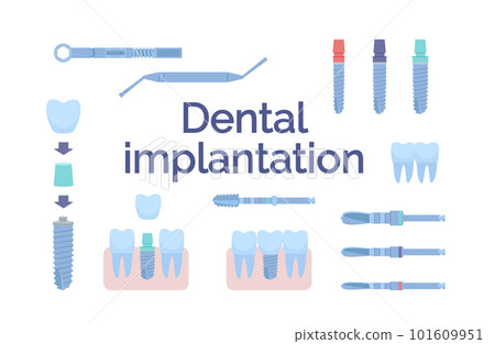 Dental tools for dental implants. Medical metal and titanium. Vector illustration, in a flat style. Poster to the clinic, image for instructions for dentists, training books. Isolated on white. Dental tools for dental implants. Medical metal and titanium. Vector illustration, in a flat style. Poster to the clinic, image for instructions for dentists, training books. Isolated on white. 101609951