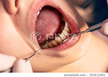 Dentist examining teeth Dentist examining teeth 101612941