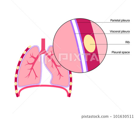 Pleura anatomical poster 101630511