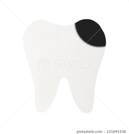Model of a tooth with caries. Isolated on a white background. Model of a tooth with caries. Isolated on a white background. 101645336