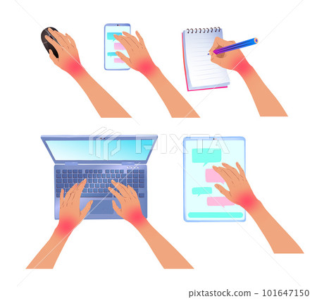 Hand with carpal tunnel syndrome Hand with carpal tunnel syndrome 101647150