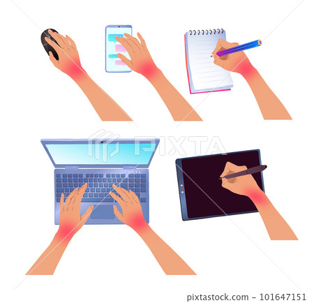 Hands with carpal tunnel syndrome 101647151