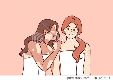 Woman with vitiligo syndrome hugs friend in bath towel and laughs enjoying fellowship and tolerance 101649491