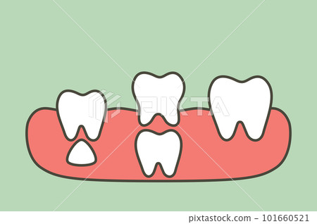 teeth are growing up from the gum by permanent tooth located below primary tooth, first tooth - dental cartoon vector flat style 101660521