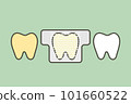 tooth whitening, yellow tooth used teeth whitening strip to whiten - dental cartoon vector flat style 101660522