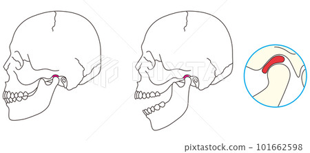 Normal temporomandibular joint structure Normal temporomandibular joint structure 101662598