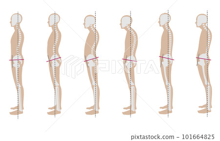 Male skeleton sample with good and bad posture 101664825