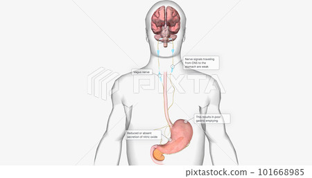 In patients with diabetes, high levels of glucose can lead to nerve damage, this is called diabetic neuropathy 101668985