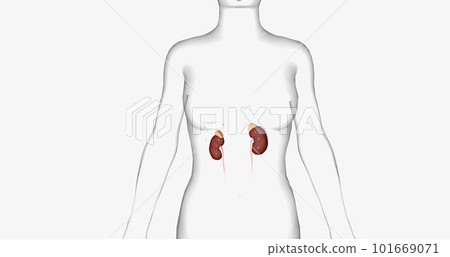 The Addison's Disease, Adrenal Gland The Addison's Disease, Adrenal Gland 101669071
