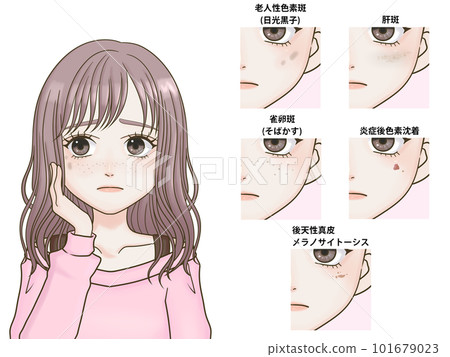 Woman suffering from dark spots and freckles, long hair 101679023