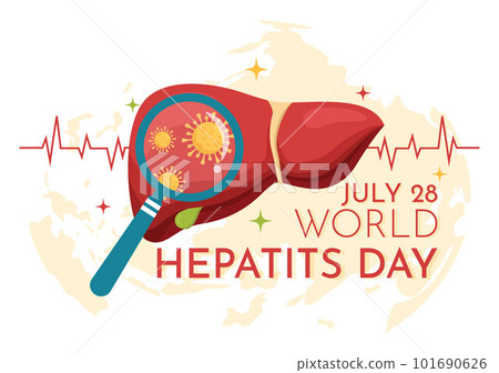 World Hepatitis Day Vector Illustration of Patient Diseased Liver, Cancer and Cirrhosis in Health Care Flat Cartoon Hand Drawn Landing Page Templates 101690626