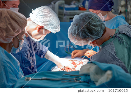 faces of surgeons in the operating room during the operation. Modern medicine, medical workers during a complex operation, modern medicine 101710015