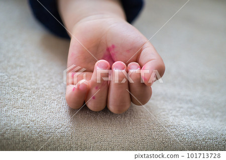 Cute palm of a toddler scribbled and smeared with a pen Cute palm of a toddler scribbled and smeared with a pen 101713728