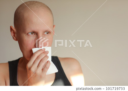 Bald cancer sick woman blowing running nose got flu cough cold, rhinitis sneezing in tissue or nosebleeds. Female is sick allergic having allergy symptoms coughing holding napkin. Misery, infelicity 101719733