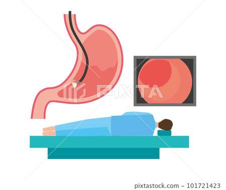 Image illustration of examination with gastroscope 101721423