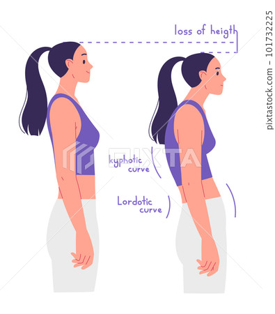 Correct and incorrect posture. The disadvantages of poor posture and the consequences of scoliosis 101732225