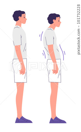 Boy with proper posture and with a posture problem 101732228