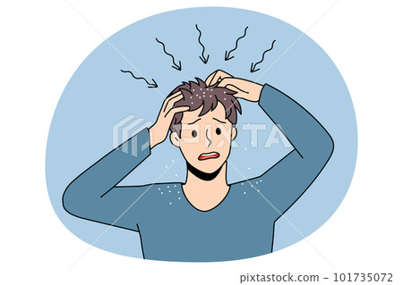Itchy head and dandruff concept. 101735072