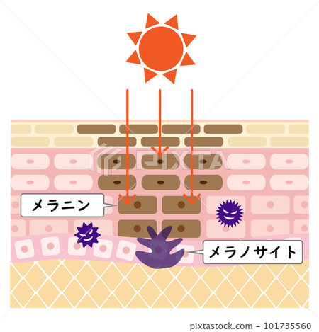 Cross section of rough skin. Image of stains caused by ultraviolet rays. Cross section of rough skin. Image of stains caused by ultraviolet rays. 101735560