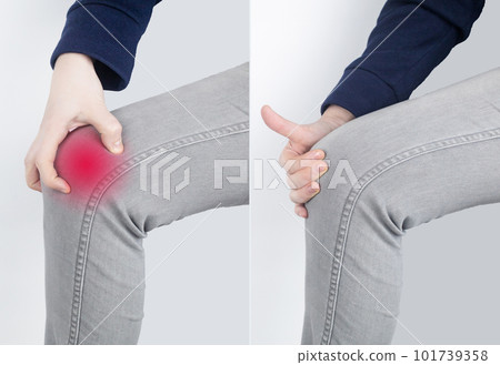 Before and after. Woman has severe knee pain. Ruptured knee tendons, muscles, meniscus injury, fracture or fracture of bones. Providing medical care for injuries to joints or cartilage tissue 101739358