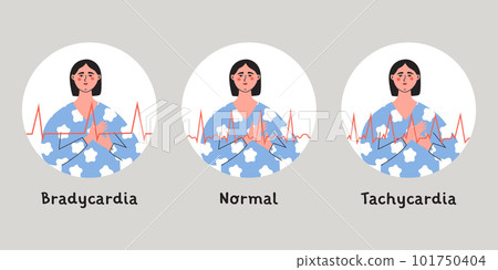 Types of heart arrhytmia. Bradycardia, tachycardia and horalhertbeat rhythm. Woman press her chest with hand. Flat vector isolated illustration 101750404
