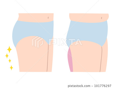 腿緊粗腿圖集 腿緊粗腿圖集 101776297