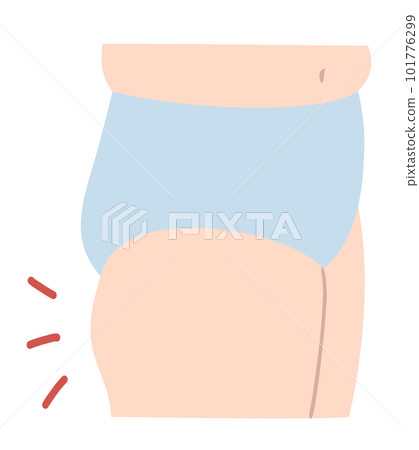 女人腿粗大粗隆的插圖素材 女人腿粗大粗隆的插圖素材 101776299