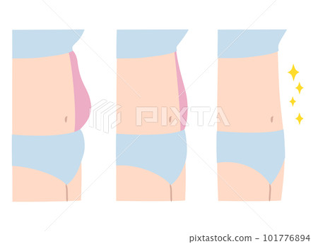 插圖集比較女性的胃 插圖集比較女性的胃 101776894