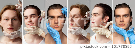 Collage. Different young men visiting cosmetologist, doing face treatment with cosmetological injections. Rejuvenation Collage. Different young men visiting cosmetologist, doing face treatment with cosmetological injections. Rejuvenation 101778593
