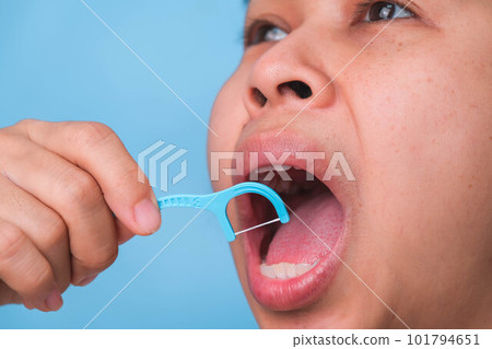 Close-up of smiling asian woman and cleaning for perfect smile. Healthy white teeth by flossing, oral health and dental care. Close-up of smiling asian woman and cleaning for perfect smile. Healthy white teeth by flossing, oral health and dental care. 101794651