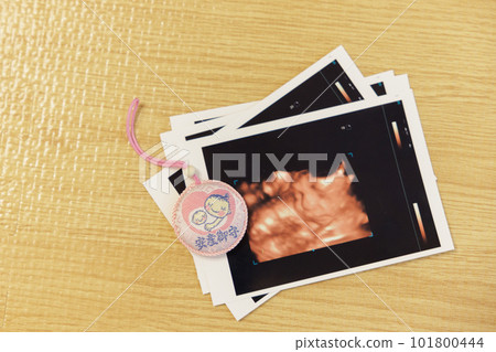 迴聲照片孕婦標記 101800444