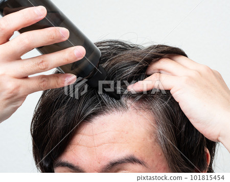 A man applying a hair restorer to his scalp Scalp care A man applying a hair restorer to his scalp Scalp care 101815454