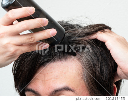 A man applying a hair restorer to his scalp Scalp care A man applying a hair restorer to his scalp Scalp care 101815455